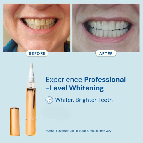 Novelix™ Whitening Pen
