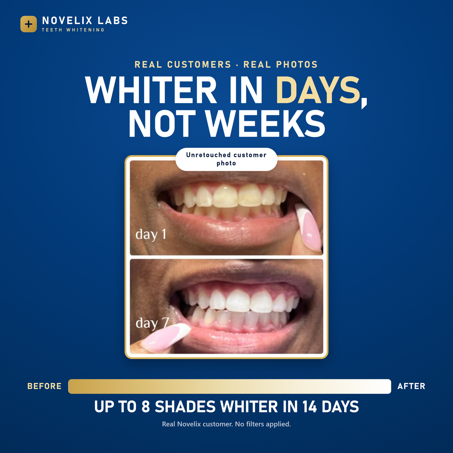 Novelix™ Pro Gold Whitening Pen