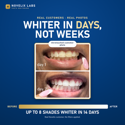 Novelix™ Pro Gold Whitening Pen