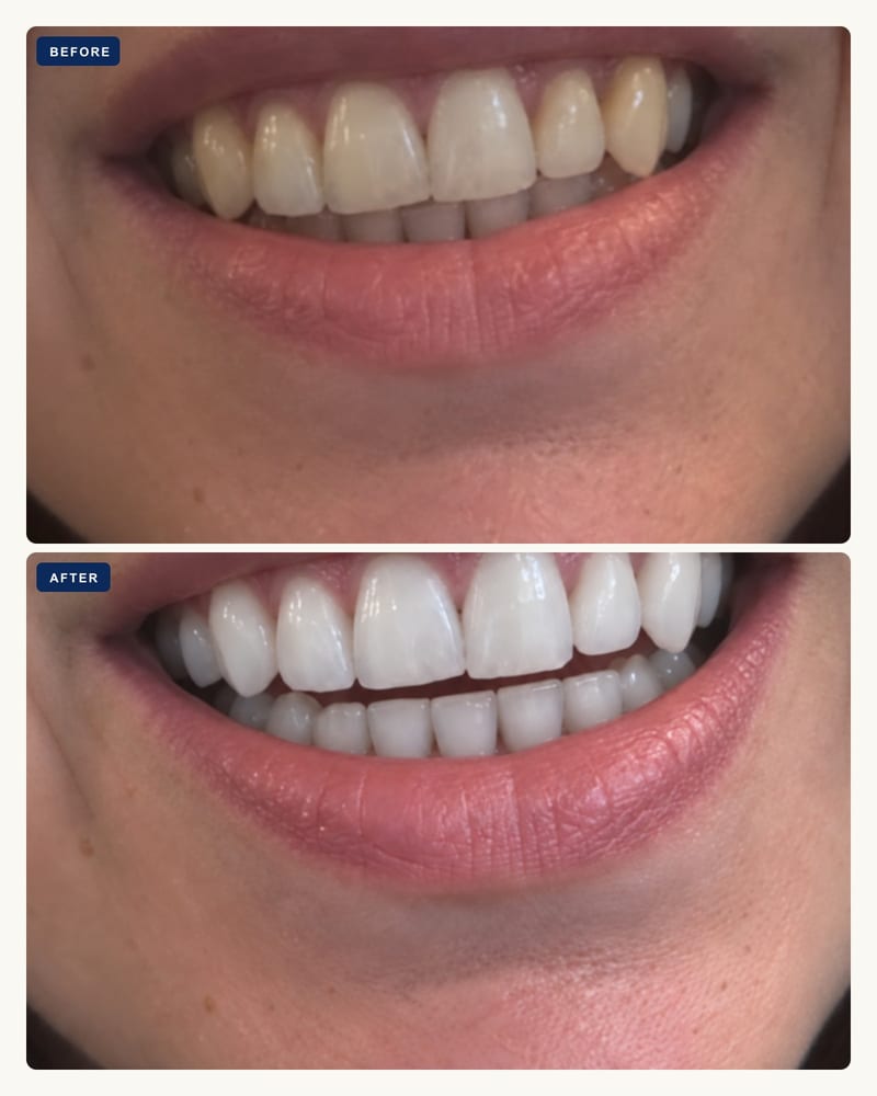 Before and after, coffee and smoke stains