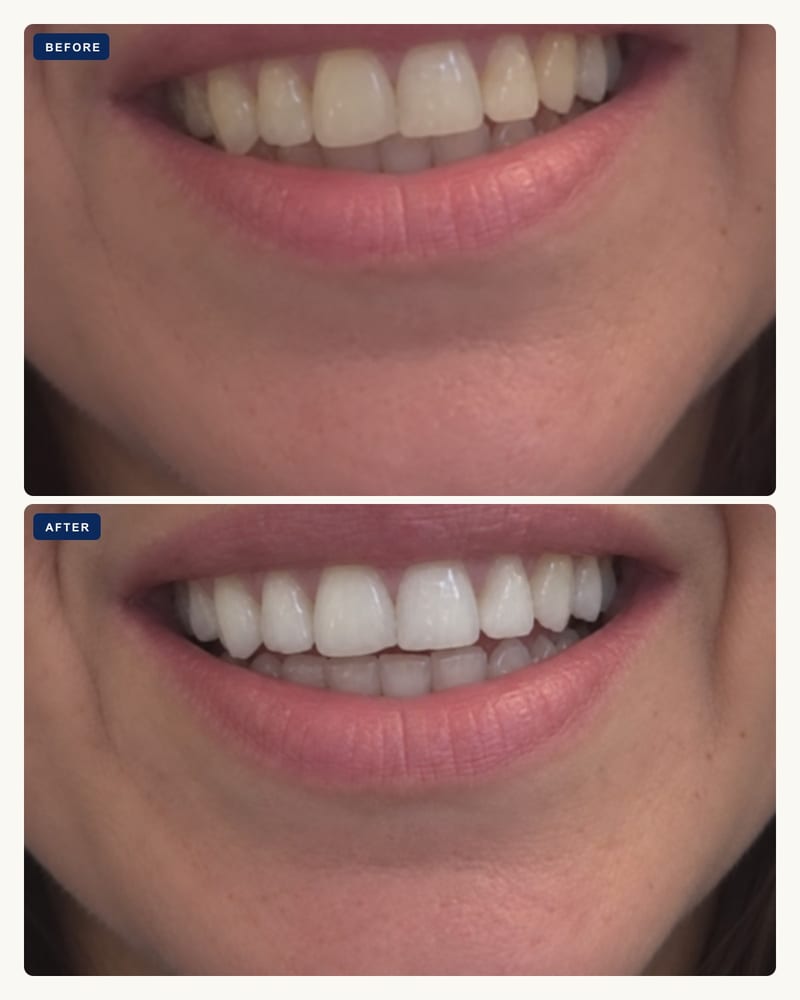 Before and after, yellow with age