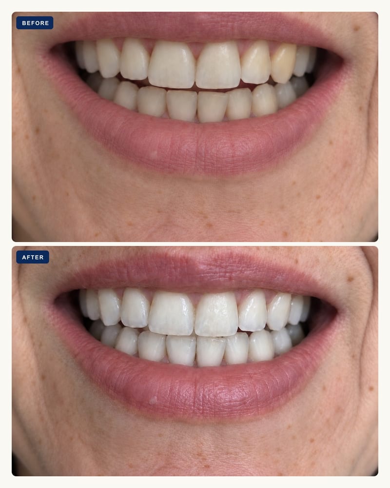 Before and after, first week