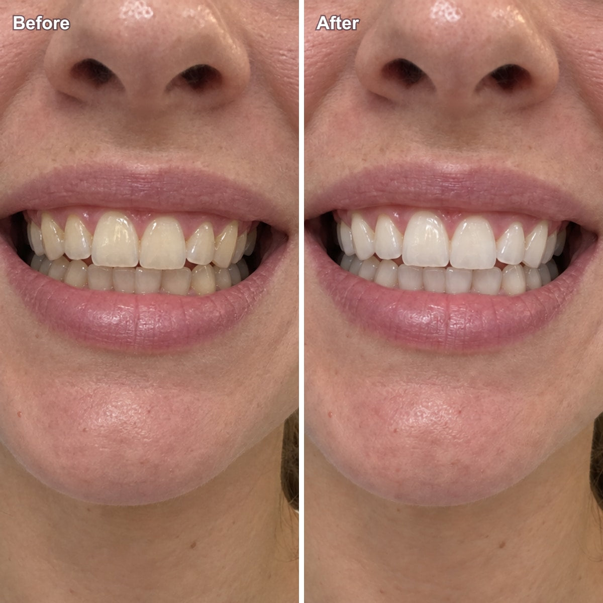 Before and after one brush, coffee stain