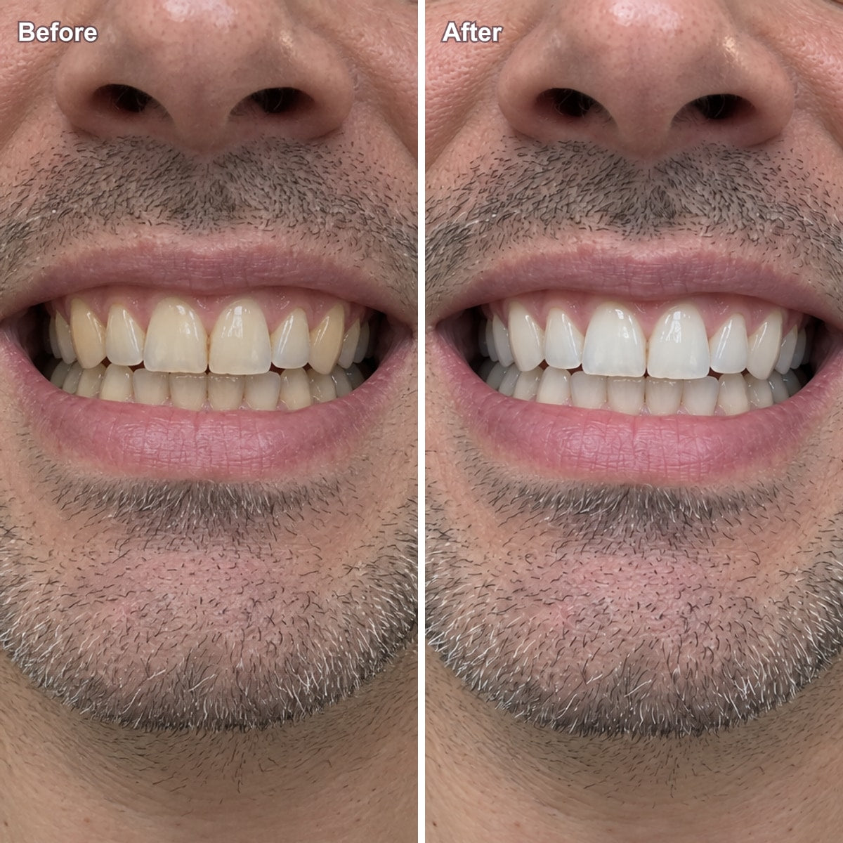 Before and after one brush, man in his forties