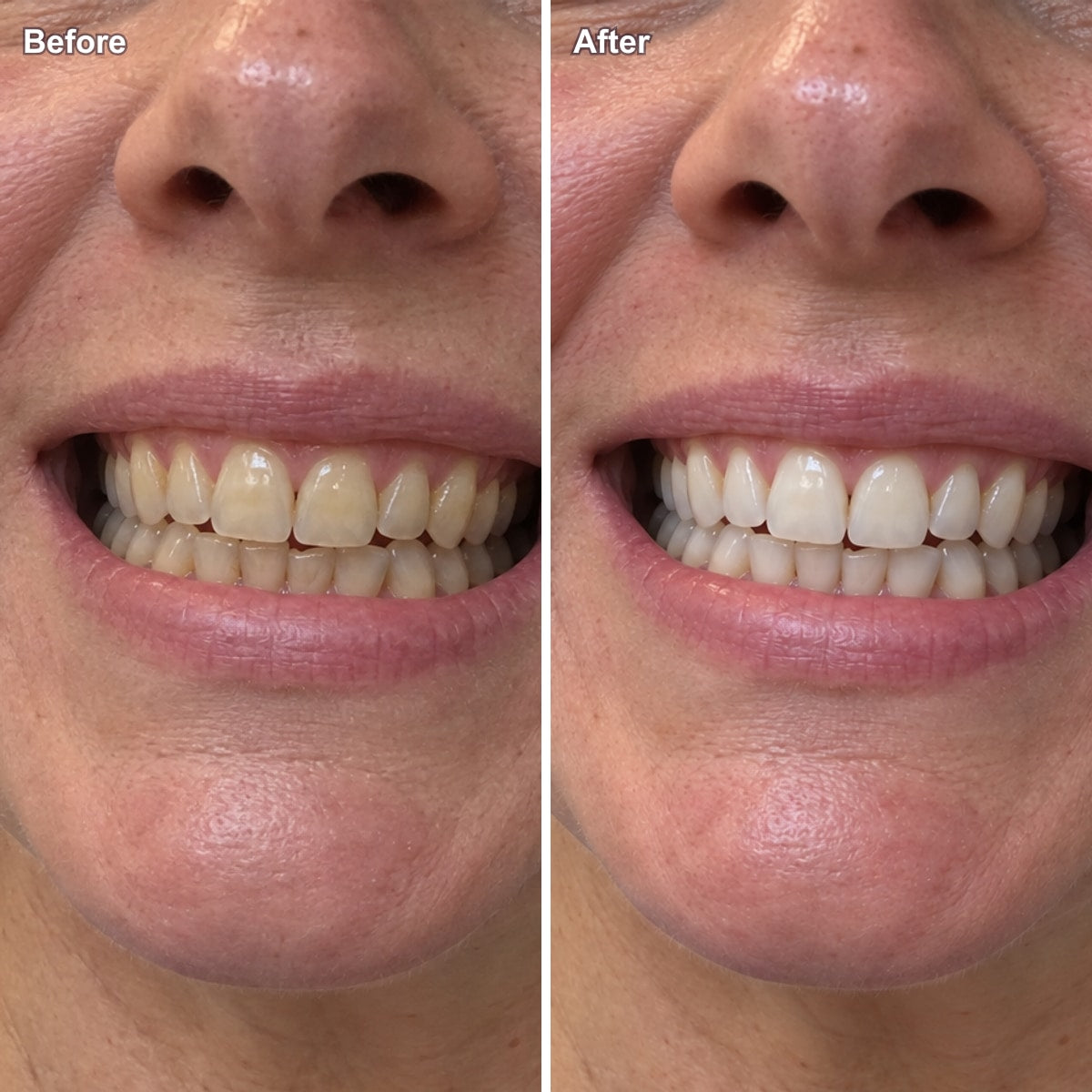 Before and after one brush, woman in her fifties